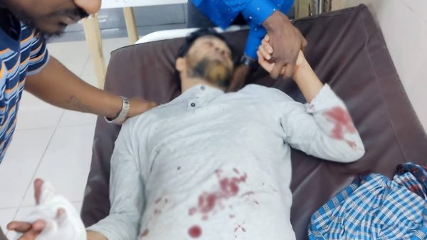 সীতাকুণ্ডে সাগর উপকূলীয় ডাকাতের হামলায় আহত ৬