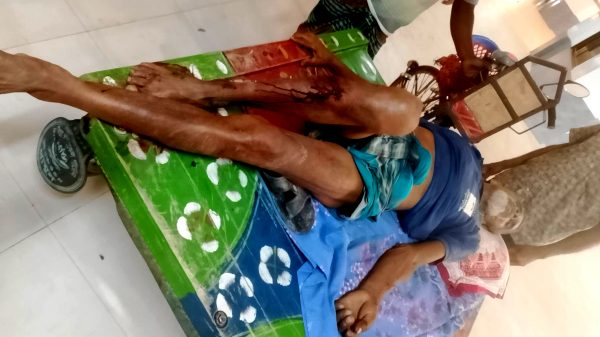 শৈলকুপায় জমাজমি বিরোধে সংঘর্ষ; কুপিয়ে জখম ২